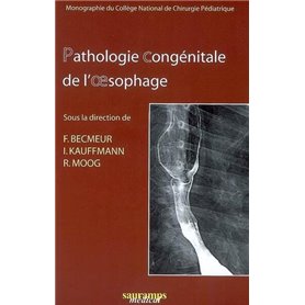 PATHOLOGIE CONGENITALE DE L'OESOPHAGE GEUP 2006