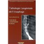 PATHOLOGIE CONGENITALE DE L'OESOPHAGE GEUP 2006