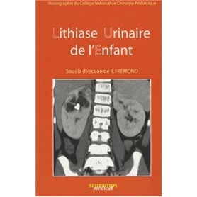 LITHIASE URINAIRE DE L'ENFANT. MONOGRAPHIE DU COLL. NAT. DE CHIRURGIE PEDIATRIQU