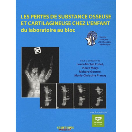 LES PERTES DE SUBSTANCE OSSEUSE ET CARTILAGINEUSE CHEZ L'ENFANT. DU LABORATOIRE