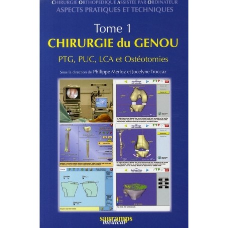 CHIRURGIE DU GENOU, TOME 1