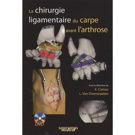 LA CHIRURGIE LIGAMENTAIRE DU CARPE AVEC DVD