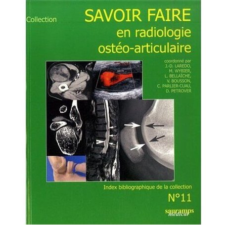 SAVOIR FAIRE EN RADIOLOGIE OSTEO-ARTICULAIRE N11