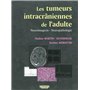 LES TUMEURS INTRACRANIENNES DE L ADULTE