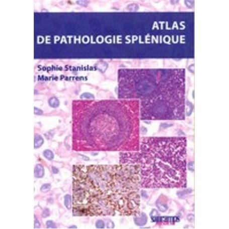 ATLAS DE PATHOLOGIE SPLENIQUE