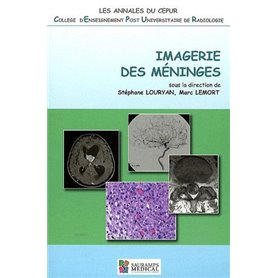 IMAGERIE DES MENINGES - ANNALES DU CEPUR