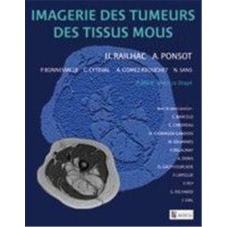 IMAGERIE DES TUMEURS DES TISSUS MOUS