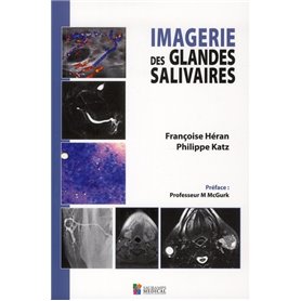 IMAGERIE DES GLANDES SALIVAIRES