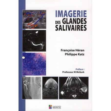 IMAGERIE DES GLANDES SALIVAIRES