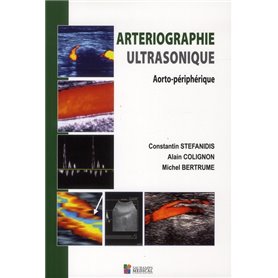 ARTERIOGRAPHIE ULTRASONIQUE