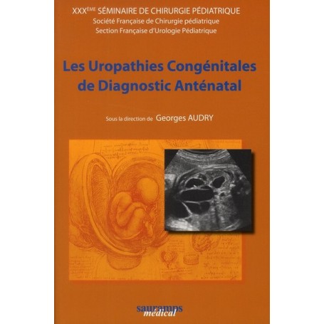 LES UROPATHIES CONGENITALES DE DIAGNOSTIC PRENATAL