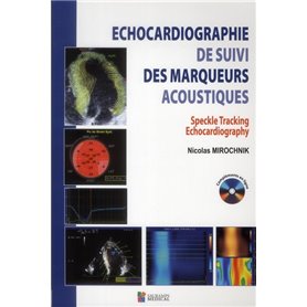 ECHOCARDIOGRAPHIE DE SUIVI DES MARQUEURS ACOUSTIQUE. SPECKLE TRACKING ECHOCARDIO