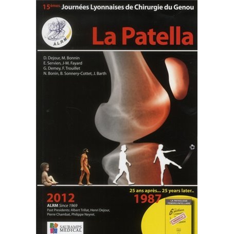 LA PATELLA - ALRM