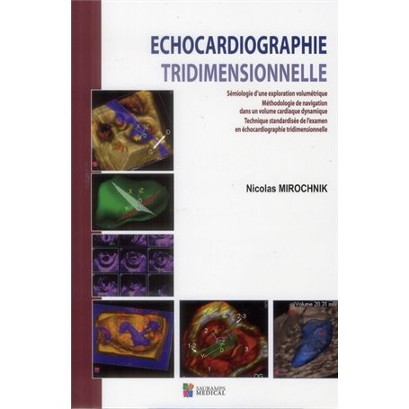 ECHOCARDIOGRAPHIE TRIDIMENSIONNELLE