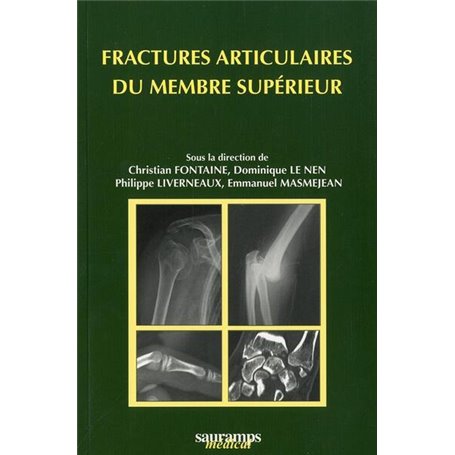 FRACTURES ARTICULAIRES DU MEMBRE SUPERIEUR