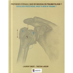 PROTHESES D'EPAULE, QUOI DE NOUVEAU EN TRAUMATOLOGIE ? SHOULDER PROSTHESIS, WHAT