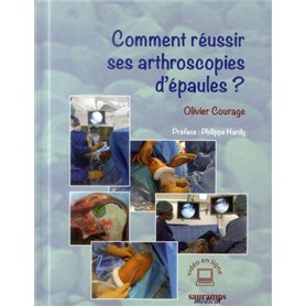 COMMENT REUSSIR SES ARTHROSCOPIES D EPAULE