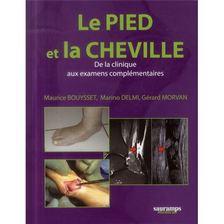 LE PIED ET LA CHEVILLE