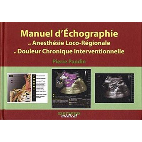 MANUEL D'ECHOGRAPHIE EN ANESTHESIE-LOCOREGIONALE ET DOULEUR CHRONIQUE INTERVENTI