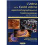 L UTERUS ET LA CAVITE UTERINE. ASPECTS ECHOGRAPHIQUES ET HYSTEROSCOPIQUES