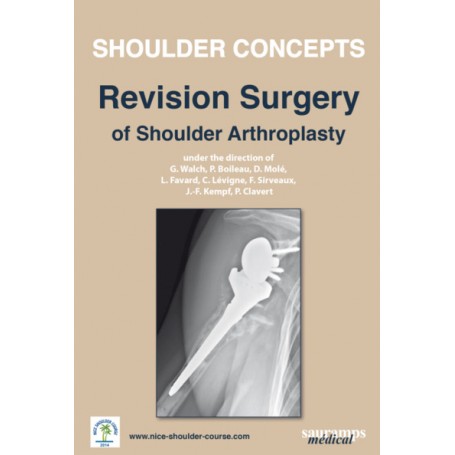 SHOULDER CONCEPTS - REVISION SURGERY OF SHOULDER ARTHROPLASTY 2014