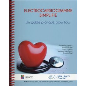 ELECTROCARDIOGRAMME SIMPLIFIE. UN GUIDE PRATIQUE POUR TOUS