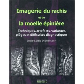 IMAGERIE DU RACHIS ET DE LA MOELLE EPINIERE