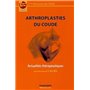 ARTHROPLASTIES DU COUDE. ACTUALITES THERAPEUTIQUES