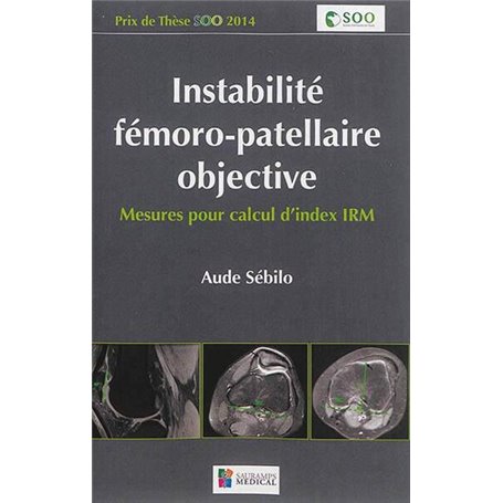 INSTABILITE FEMORO-PATELLAIRE OBJECTIVE. MESURES PAR CALCUL D INDEX IRM