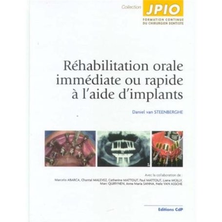 Réhabilitation orale immédiate ou rapide à l'aide d'implants