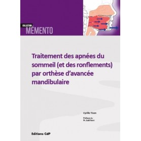 Traitement des apnées du sommeil (et des ronflements) par orthèse d'avancée mandibulaire