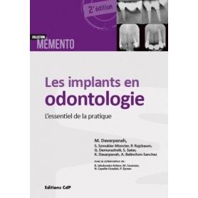 Les implants en odontologie