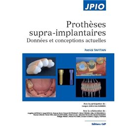 Prothèses supra-implantaires