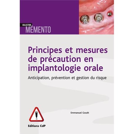 Principes et mesures de précaution en implantologie