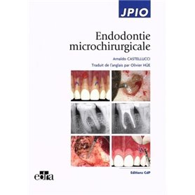 Endodontie microchirurgicale