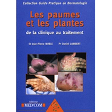 LES PAUMES ET LES PLANTES