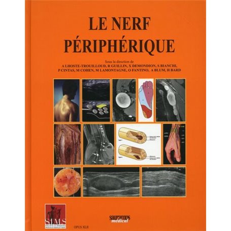 LE NERF PERIPHERIQUE - SIMS