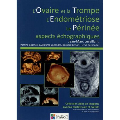 L OVAIRE ET LA TROMPE-L ENDOMETRIOSE-LE PERINEE-ASPECTS ECHOGRAPHIQUES