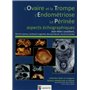 L OVAIRE ET LA TROMPE-L ENDOMETRIOSE-LE PERINEE-ASPECTS ECHOGRAPHIQUES