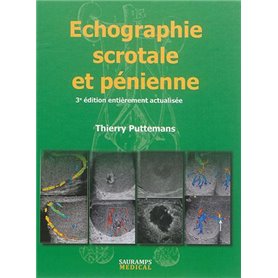 ECHOGRAPHIE SCROTALE ET PENIENNE