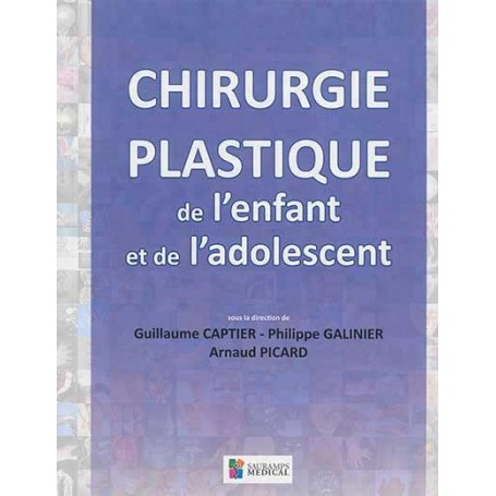 CHIRURGIE PLASTIQUE DE L ENFANT ET DE L ADOLESCENT