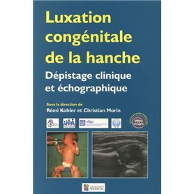 LUXATION CONGENITALE DE LA HANCHE. DEPISTAGE CLINIQUE ET ECHOGRAPHIQUE