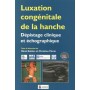 LUXATION CONGENITALE DE LA HANCHE. DEPISTAGE CLINIQUE ET ECHOGRAPHIQUE