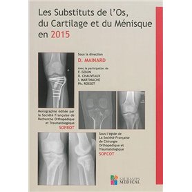 LES SUBSTITUTS DE L OS, DU CARTILAGE ET DU MENISQUE EN 2015