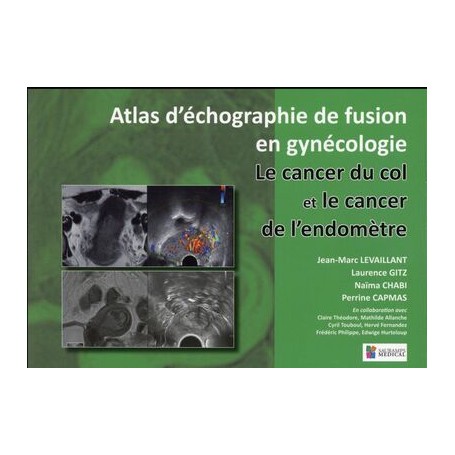 LE CANCER DU COL ET LE CANCER DE L ENDOMETRE. ATLAS D ECHOGRAPHIE FUSION EN GYN