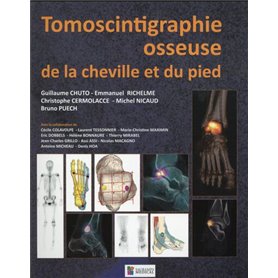 TOMOSCINTIGRAPHIE OSSEUSE DE LA CHEVILLE ET DU PIED