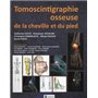 TOMOSCINTIGRAPHIE OSSEUSE DE LA CHEVILLE ET DU PIED