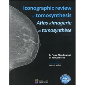 ICONOGRAPHIC REVIEW OF TOMOSYNTHESIS. ATLAS D IMAGERIE DE TOMOSYNTHESE