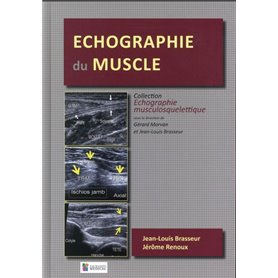 ECHOGRAPHIE DU MUSCLE