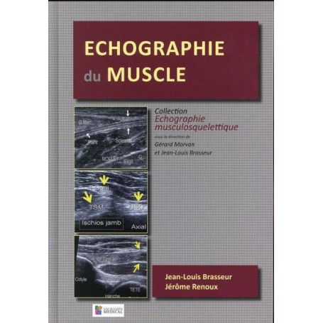 ECHOGRAPHIE DU MUSCLE